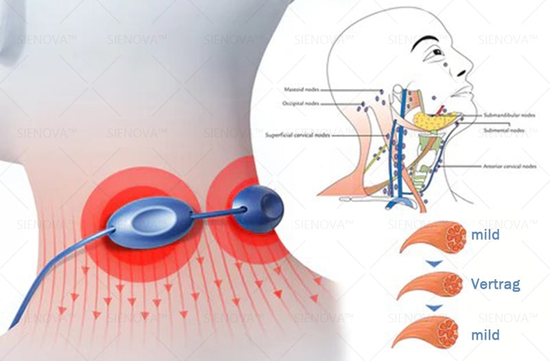 SIENO𝖵𝖠™🌸 Tragbares Lymphdrainage- und Gelenkentspannungs-Therapiegerät 👨‍⚕️ Original 2-in-1-Therapie | Empfohlen von ESPT✅