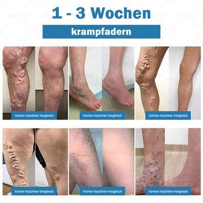 SIENO𝖵𝖠™🌸 Tragbares Lymphdrainage- und Gelenkentspannungs-Therapiegerät 👨‍⚕️ Original 2-in-1-Therapie | Empfohlen von ESPT✅