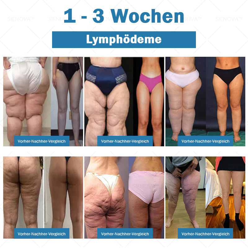 SIENO𝖵𝖠™🌸 Tragbares Lymphdrainage- und Gelenkentspannungs-Therapiegerät 👨‍⚕️ Original 2-in-1-Therapie | Empfohlen von ESPT✅