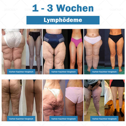 SIENO𝖵𝖠™🌸 Tragbares Lymphdrainage- und Gelenkentspannungs-Therapiegerät 👨‍⚕️ Original 2-in-1-Therapie | Empfohlen von ESPT✅