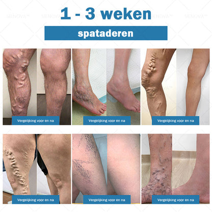 SIE𝖭𝖮𝖵𝖠™🍂 Draagbare Lymfatische Detox en Gewrichtsontspanning Behandelapparaat👨‍⚕️ Aanbevolen door MHRA✅