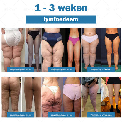SIE𝖭𝖮𝖵𝖠™🍂 Draagbare Lymfatische Detox en Gewrichtsontspanning Behandelapparaat👨‍⚕️ Aanbevolen door MHRA✅